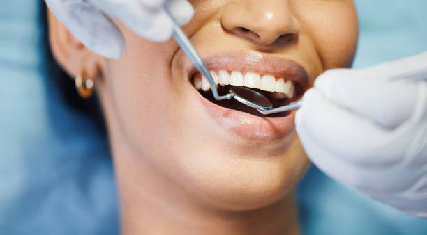 Best Broken or Chipped Tooth Repair in West Sand Lake, NY