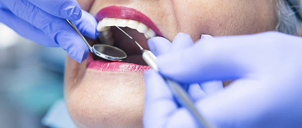 Best Emergency Denture Repair in West Sand Lake, NY
